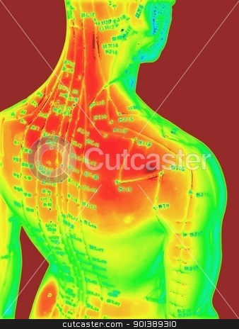 Acupuncture Concept Acupuncture Concept stock photo, The Eastern or Asian acupuncture medical treatment said to prevent or treat a variety of medical ailments, including pain. by Cora Reed