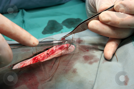 Stitching - medical stock photos Stitching - medical stock photos stock photo, A surgeon is closing a wound by stitching - medical stock photos by Paul Hakimata
