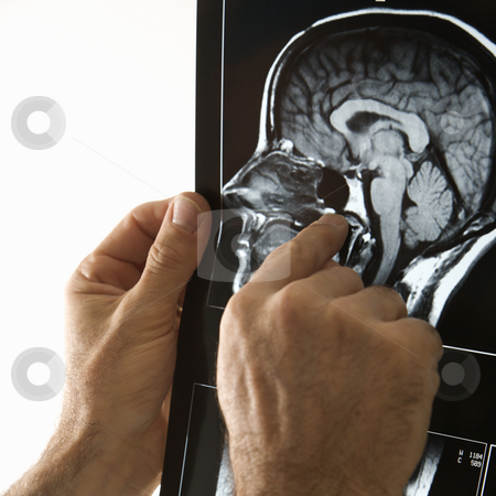 To use this stock image in your creative project, please select the size you need over to the right and click the "Add to Cart" button.
Your downloaded image will come with the Cutcaster watermark removed so don’t worry about the watermark you see on this page. Man holding x ray. stock photo, Mid-adult Caucasian male hands pointing at an x-ray. by Iofoto Images
