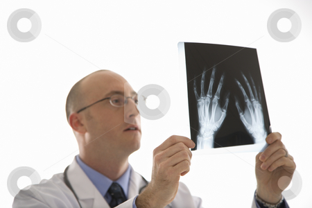 Doctor looking at xrays. Doctor looking at xrays. stock photo, Caucasian mid adult male physician holding up hand xrays. by Iofoto Images