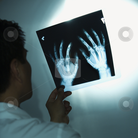 To use this stock image in your creative project, please select the size you need over to the right and click the "Add to Cart" button.
Your downloaded image will come with the Cutcaster watermark removed so don’t worry about the watermark you see on this page. Doctor examining x-rays. stock photo, Asian American male doctor examining x-rays. by Iofoto Images