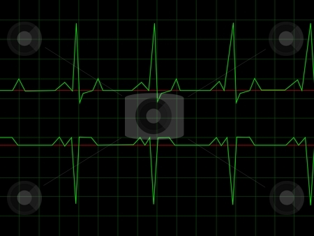 Normal Heart Rhythm Normal Heart Rhythm stock photo, Normal Heart Rhythm electrocardiogram ECG graph with black background by Henrik Lehnerer