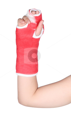 Red cast on girl Red cast on girl stock photo, Red cast on a child isolated on white background by Stacy Barnett