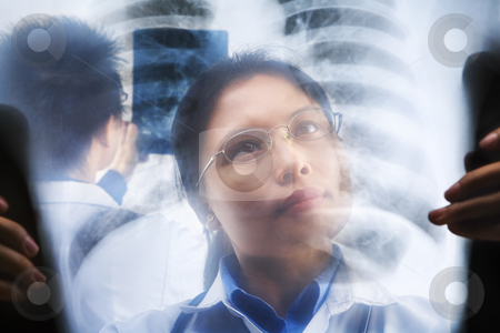 To use this stock image in your creative project, please select the size you need over to the right and click the "Add to Cart" button.
Your downloaded image will come with the Cutcaster watermark removed so don’t worry about the watermark you see on this page. Asian doctors busy working stock photo, Asian doctors busy working on xray result. PS:the image taken from behind the xray print, so it may leave some soft noise on the people image behind it. by Rudyanto Wijaya