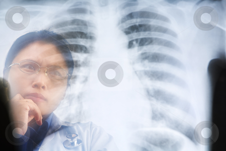 To use this stock image in your creative project, please select the size you need over to the right and click the "Add to Cart" button.
Your downloaded image will come with the Cutcaster watermark removed so don’t worry about the watermark you see on this page. Asian female doctor busy working on x-ray result stock photo, Asian female doctor busy working on x-ray result. PS:the image taken from behind the xray print, so it may leave some soft noise on the people image behind it. by Rudyanto Wijaya