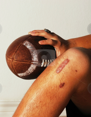 injury in football. #800901756 ACL football Injury