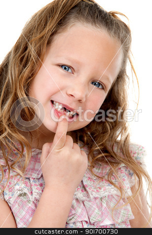 To use this stock image in your creative project, please select the size you need over to the right and click the "Add to Cart" button.
Your downloaded image will come with the Cutcaster watermark removed so don’t worry about the watermark you see on this page. Close up portrait of girl showing missing teeth. stock photo, Close up Portrait of cute little girl showing her missing teeth. Isolated on white background. by karel noppe