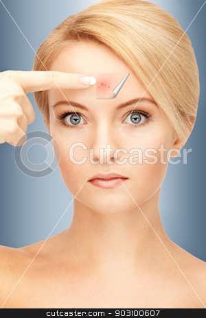 To use this stock image in your creative project, please select the size you need over to the right and click the "Add to Cart" button.
Your downloaded image will come with the Cutcaster watermark removed so don’t worry about the watermark you see on this page. no more acne stock photo, picture of beautiful woman pointing to forehead by Syda Productions