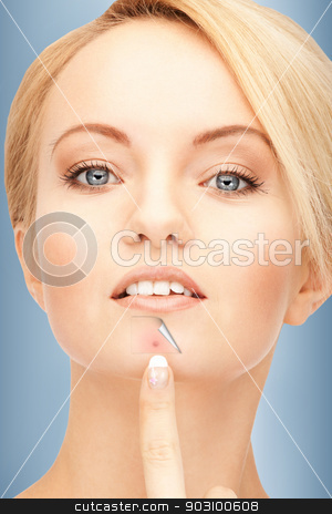 To use this stock image in your creative project, please select the size you need over to the right and click the "Add to Cart" button.
Your downloaded image will come with the Cutcaster watermark removed so don’t worry about the watermark you see on this page. no more acne stock photo, bright closeup portrait picture of beautiful woman. pointing to chin by Syda Productions