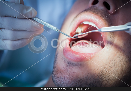 To use this stock image in your creative project, please select the size you need over to the right and click the "Add to Cart" button.
Your downloaded image will come with the Cutcaster watermark removed so don’t worry about the watermark you see on this page. Close up of man having his teeth examined stock photo, Close up of man having his teeth examined by dentist by Wavebreak Media