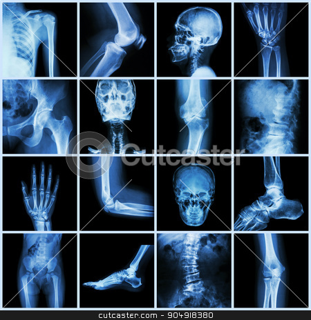 To use this stock image in your creative project, please select the size you need over to the right and click the "Add to Cart" button.
Your downloaded image will come with the Cutcaster watermark removed so don’t worry about the watermark you see on this page. Collection human joint ( skull head neck shoulder chest thorax shoulder arm elbow forearm wrist hand finger palm spine back pelvis thigh knee leg foot ankle toe) stock photo, Collection human joint ( skull head neck shoulder chest thorax shoulder arm elbow forearm wrist hand finger palm spine back pelvis thigh knee leg foot ankle toe) by stockdevil