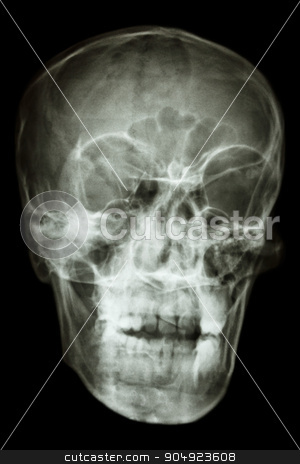To use this stock image in your creative project, please select the size you need over to the right and click the "Add to Cart" button.
Your downloaded image will come with the Cutcaster watermark removed so don’t worry about the watermark you see on this page. asian people's skull (Thai people) stock photo, film x-ray asian people's skull (Thai people) by stockdevil