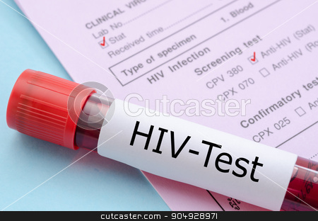 To use this stock image in your creative project, please select the size you need over to the right and click the "Add to Cart" button.
Your downloaded image will come with the Cutcaster watermark removed so don’t worry about the watermark you see on this page. Sample blood collection tube with HIV test. stock photo, Sample blood collection tube with HIV test label on HIV infection screening test form. by Miss. PENCHAN PUMILA