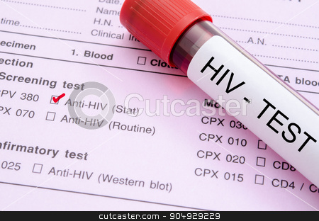 To use this stock image in your creative project, please select the size you need over to the right and click the "Add to Cart" button.
Your downloaded image will come with the Cutcaster watermark removed so don’t worry about the watermark you see on this page. Sample blood collection tube with HIV test label. stock photo, Sample blood collection tube with HIV test label on HIV infection screening test form. by Miss. PENCHAN PUMILA