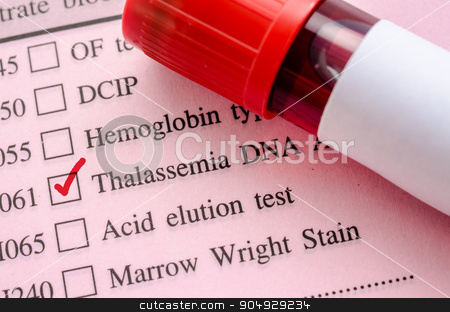 To use this stock image in your creative project, please select the size you need over to the right and click the "Add to Cart" button.
Your downloaded image will come with the Cutcaster watermark removed so don’t worry about the watermark you see on this page. Sample blood in blood tube for Thalassemia DNA test. stock photo, Sample blood in blood tube for Thalassemia DNA test on request form in laboratory. by Miss. PENCHAN PUMILA