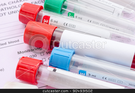 To use this stock image in your creative project, please select the size you need over to the right and click the "Add to Cart" button.
Your downloaded image will come with the Cutcaster watermark removed so don’t worry about the watermark you see on this page. Blood sample test and empty tube blood for blood test screening. stock photo, Blood sample test and empty tube blood for blood test screening on form screening background. by Miss. PENCHAN PUMILA