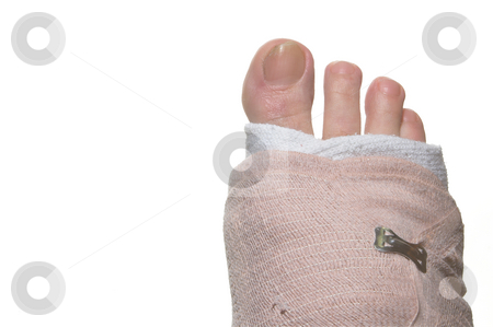 To use this stock image in your creative project, please select the size you need over to the right and click the "Add to Cart" button.
Your downloaded image will come with the Cutcaster watermark removed so don’t worry about the watermark you see on this page. Broken Foot stock photo, A broken foot wrapped up in a temporary bandage. by Robert Byron