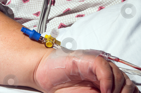 To use this stock image in your creative project, please select the size you need over to the right and click the "Add to Cart" button.
Your downloaded image will come with the Cutcaster watermark removed so don’t worry about the watermark you see on this page. Patient with IV stock photo, A medical hospital patient with an IV. by Robert Byron