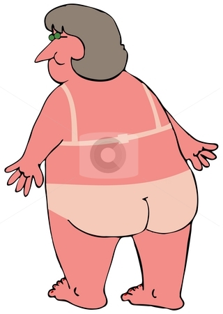 To use this stock image in your creative project, please select the size you need over to the right and click the "Add to Cart" button.
Your downloaded image will come with the Cutcaster watermark removed so don’t worry about the watermark you see on this page. Sunburned Woman stock photo, This illustration depicts a chubby woman viewed from the back with bikini lines on her sunburn. by Dennis Cox
