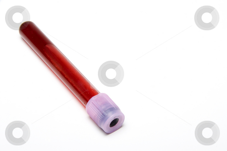 To use this stock image in your creative project, please select the size you need over to the right and click the "Add to Cart" button.
Your downloaded image will come with the Cutcaster watermark removed so don’t worry about the watermark you see on this page. Blood Samples stock photo, Blood samples in glass laboratory test tubes. by Robert Byron