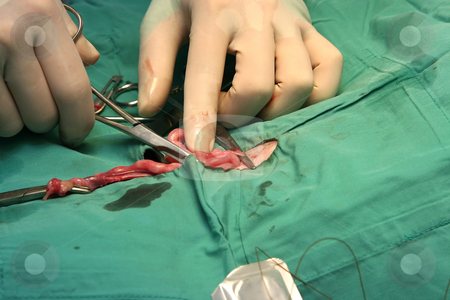 To use this stock image in your creative project, please select the size you need over to the right and click the "Add to Cart" button.
Your downloaded image will come with the Cutcaster watermark removed so don’t worry about the watermark you see on this page. Surgical procedure stock photo, Surgeon doing an operation on an intestine by Paul Hakimata