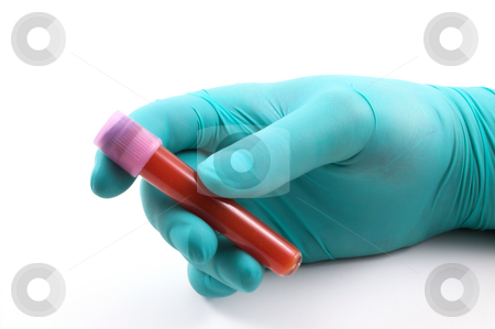 To use this stock image in your creative project, please select the size you need over to the right and click the "Add to Cart" button.
Your downloaded image will come with the Cutcaster watermark removed so don’t worry about the watermark you see on this page. Blood Sample stock photo, A patient's blood sample in a medical facility. by Robert Byron
