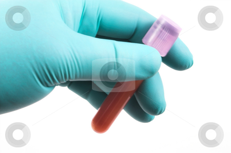 To use this stock image in your creative project, please select the size you need over to the right and click the "Add to Cart" button.
Your downloaded image will come with the Cutcaster watermark removed so don’t worry about the watermark you see on this page. Blood Samples stock photo, Blood samples in glass laboratory test tubes. by Robert Byron