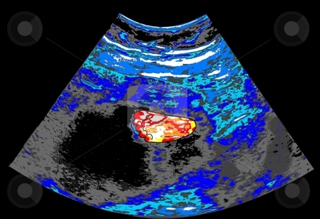 To use this stock image in your creative project, please select the size you need over to the right and click the "Add to Cart" button.
Your downloaded image will come with the Cutcaster watermark removed so don’t worry about the watermark you see on this page. Ultrasound with Baby Foot stock photo, Painted ultrasound with a baby's foot - a raster illustration. by Karen Carter