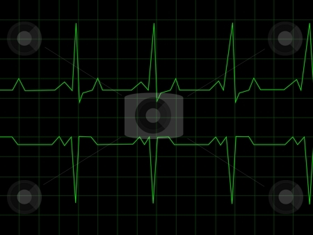 To use this stock image in your creative project, please select the size you need over to the right and click the "Add to Cart" button.
Your downloaded image will come with the Cutcaster watermark removed so don’t worry about the watermark you see on this page. Normal Heart Rhythm stock photo, Normal Heart Rhythm electrocardiogram ECG graph with black background by Henrik Lehnerer