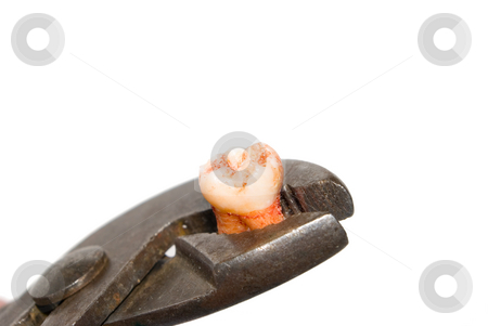 To use this stock image in your creative project, please select the size you need over to the right and click the "Add to Cart" button.
Your downloaded image will come with the Cutcaster watermark removed so don’t worry about the watermark you see on this page. Tooth extraction, (p0476) stock photo, Tooth extraction. by Germán Ariel Berra