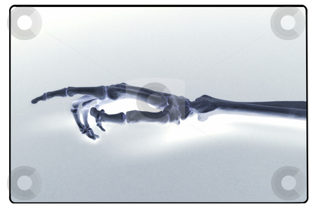 To use this stock image in your creative project, please select the size you need over to the right and click the "Add to Cart" button.
Your downloaded image will come with the Cutcaster watermark removed so don’t worry about the watermark you see on this page. X-ray of human hand and forearm stock photo, X-ray like shot of human hand and forearm by James Barber