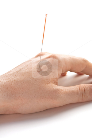 To use this stock image in your creative project, please select the size you need over to the right and click the "Add to Cart" button.
Your downloaded image will come with the Cutcaster watermark removed so don’t worry about the watermark you see on this page. Acupunctured hand (vertical) stock photo, Acupunctured hand on the white background by Tatsiana Amelina