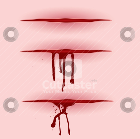 To use this stock image in your creative project, please select the size you need over to the right and click the "Add to Cart" button.
Your downloaded image will come with the Cutcaster watermark removed so don’t worry about the watermark you see on this page. Blood cut bleeding stock vector clipart, Three illustrated open wounds with blood pooring from them by Michael Travers